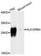 Major Histocompatibility Complex, Class II, DR Beta 4 antibody, abx135996, Abbexa, Western Blot image 