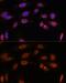 Thyroid Hormone Receptor Beta antibody, GTX16393, GeneTex, Immunofluorescence image 