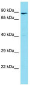 CD248 Molecule antibody, TA342773, Origene, Western Blot image 