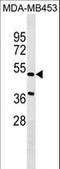 Nephronectin antibody, LS-C158419, Lifespan Biosciences, Western Blot image 