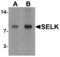 Selenoprotein K antibody, GTX32088, GeneTex, Western Blot image 