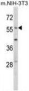 Early Growth Response 1 antibody, GTX81956, GeneTex, Western Blot image 