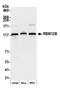 RNA Binding Motif Protein 12B antibody, NBP2-77353, Novus Biologicals, Western Blot image 