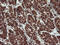 Ubiquinol-Cytochrome C Reductase Core Protein 1 antibody, M06974-1, Boster Biological Technology, Immunohistochemistry paraffin image 