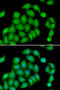 Aspartate Beta-Hydroxylase antibody, STJ28953, St John