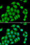 Aspartyl/asparaginyl beta-hydroxylase antibody, STJ28953, St John