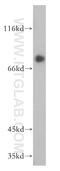 Transferrin antibody, 17435-1-AP, Proteintech Group, Western Blot image 