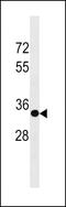 Sprouty RTK Signaling Antagonist 3 antibody, PA5-49294, Invitrogen Antibodies, Western Blot image 