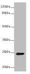 Growth Hormone 2 antibody, A59222-100, Epigentek, Western Blot image 