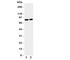 Gelsolin antibody, R31221, NSJ Bioreagents, Western Blot image 