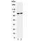 ADF antibody, R31221, NSJ Bioreagents, Western Blot image 