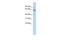 Zinc Finger Protein 468 antibody, PA5-69738, Invitrogen Antibodies, Western Blot image 