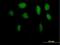 Zinc Finger With KRAB And SCAN Domains 5 antibody, H00023660-B01P, Novus Biologicals, Immunofluorescence image 