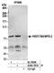 HSD17B4 antibody, A304-797A, Bethyl Labs, Immunoprecipitation image 