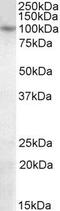 PR/SET Domain 1 antibody, GTX89762, GeneTex, Western Blot image 