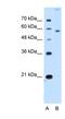 Solute Carrier Family 22 Member 2 antibody, NBP1-59451, Novus Biologicals, Western Blot image 