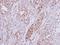 Ribosomal Protein S10 antibody, LS-C185436, Lifespan Biosciences, Immunohistochemistry paraffin image 