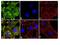 Paxillin antibody, GTX24832, GeneTex, Immunocytochemistry image 
