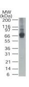 5'-Aminolevulinate Synthase 1 antibody, PA1-41152, Invitrogen Antibodies, Western Blot image 