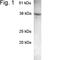 Secretory Carrier Membrane Protein 2 antibody, NB120-3431, Novus Biologicals, Western Blot image 