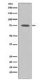 Somatostatin Receptor 2 antibody, M01689, Boster Biological Technology, Western Blot image 