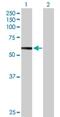 Hexosaminidase Subunit Beta antibody, H00003074-B01P, Novus Biologicals, Western Blot image 