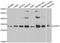 SURF1 Cytochrome C Oxidase Assembly Factor antibody, STJ28841, St John
