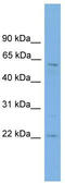 Alpha-ketoglutarate-dependent dioxygenase FTO antibody, TA342385, Origene, Western Blot image 