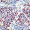 Cyclin Dependent Kinase Inhibitor 1C antibody, LS-C88549, Lifespan Biosciences, Immunohistochemistry paraffin image 
