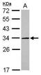 UTP11 Small Subunit Processome Component antibody, PA5-30550, Invitrogen Antibodies, Western Blot image 