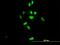 PAX3 And PAX7 Binding Protein 1 antibody, H00094104-B01P, Novus Biologicals, Immunofluorescence image 