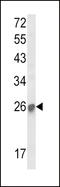 Suppressor Of Cytokine Signaling 1 antibody, LS-C161380, Lifespan Biosciences, Western Blot image 