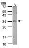 Peroxisomal Biogenesis Factor 26 antibody, PA5-22033, Invitrogen Antibodies, Western Blot image 