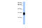 Triosephosphate Isomerase 1 antibody, 26-284, ProSci, Enzyme Linked Immunosorbent Assay image 