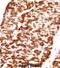 Desmin antibody, abx027938, Abbexa, Immunohistochemistry paraffin image 