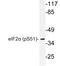 Eukaryotic Translation Initiation Factor 2 Subunit Alpha antibody, LS-C178050, Lifespan Biosciences, Western Blot image 