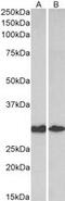 Galectin 3 antibody, MBS423380, MyBioSource, Western Blot image 