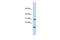 RNA Polymerase II Subunit K antibody, GTX46208, GeneTex, Western Blot image 