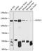 Exocyst Complex Component 4 antibody, GTX66103, GeneTex, Western Blot image 