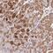 Mitochondrial Ribosomal Protein S31 antibody, HPA046344, Atlas Antibodies, Immunohistochemistry paraffin image 