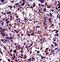 Ras Homolog Family Member C antibody, LS-C162595, Lifespan Biosciences, Immunohistochemistry frozen image 