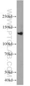 Ras Protein Specific Guanine Nucleotide Releasing Factor 1 antibody, 12958-1-AP, Proteintech Group, Western Blot image 