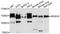 O-GlcNAcase antibody, STJ111534, St John