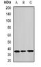 Annexin A8-like protein 1 antibody, LS-B16065, Lifespan Biosciences, Western Blot image 