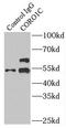 Coronin 1C antibody, FNab01883, FineTest, Immunoprecipitation image 