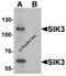 SIK Family Kinase 3 antibody, 6613, ProSci, Western Blot image 