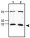 Lipocalin 2 antibody, ab63929, Abcam, Western Blot image 