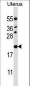 Cyclin Dependent Kinase Inhibitor 1B antibody, LS-C159324, Lifespan Biosciences, Western Blot image 