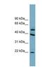 UFM1 Specific Peptidase 2 antibody, NBP1-70740, Novus Biologicals, Western Blot image 