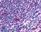 C-C Motif Chemokine Receptor 2 antibody, LS-A1899, Lifespan Biosciences, Immunohistochemistry paraffin image 